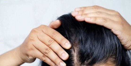 I migliori shampoo per i capelli grassi I migliori shampoo per i capelli grassi